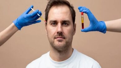 PRP Treatment in Kolkata​