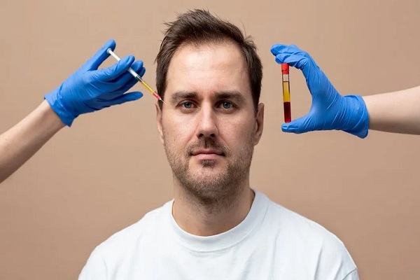 PRP Treatment in Kolkata