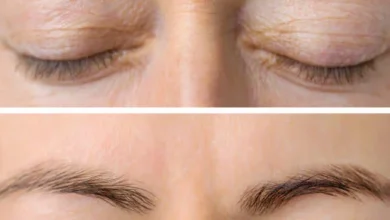 Best Hair Botox Treatment