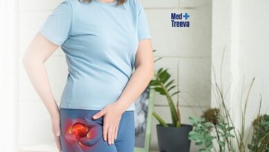 Hip Replacement Surgery in India